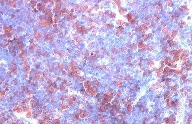 Anti-Thymidylate synthase antibody [HL1237] used in IHC (Paraffin sections) (IHC-P). GTX636636