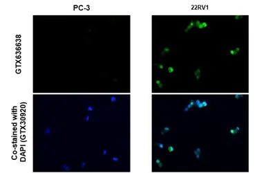 Anti-Androgen Receptor (ARv7 Splice Variant) antibody [HL1239] used in IHC-P (cell pellet) (IHC-P (cell pellet)). GTX636638
