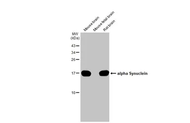 Anti-alpha Synuclein antibody [HL1243] used in Western Blot (WB). GTX636642