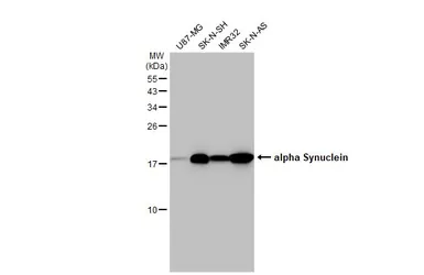 Anti-alpha Synuclein antibody [HL1243] used in Western Blot (WB). GTX636642