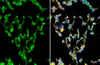 Anti-alpha Synuclein antibody [HL1243] used in Immunocytochemistry/ Immunofluorescence (ICC/IF). GTX636642