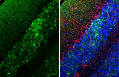 Anti-alpha Synuclein antibody [HL1243] used in IHC (Paraffin sections) (IHC-P). GTX636642
