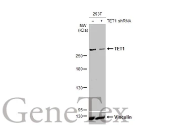 Anti-TET1 antibody [GT2457] used in Western Blot (WB). GTX636645