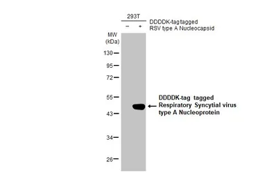 Anti-Respiratory Syncytial virus Nucleoprotein antibody [HL1246] used in Western Blot (WB). GTX636648