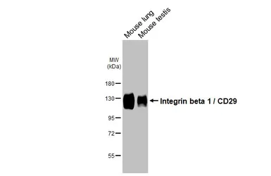 Anti-Integrin beta 1 / CD29 antibody [HL1255] used in Western Blot (WB). GTX636657