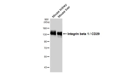 Anti-Integrin beta 1 / CD29 antibody [HL1255] used in Western Blot (WB). GTX636657