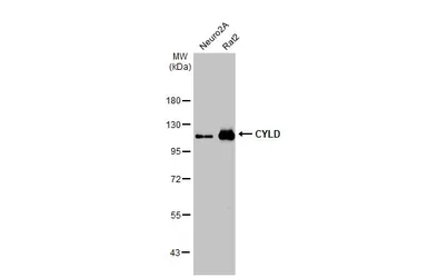 Anti-CYLD antibody [HL1260] used in Western Blot (WB). GTX636662
