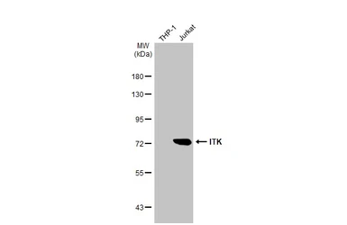 Anti-ITK antibody [HL1264] used in Western Blot (WB). GTX636666