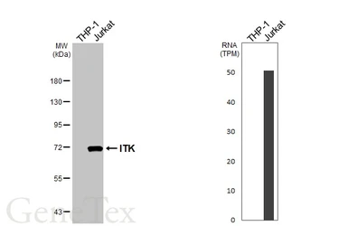 Anti-ITK antibody [HL1264] used in Western Blot (WB). GTX636666