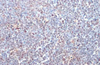 Anti-ITK antibody [HL1264] used in IHC (Paraffin sections) (IHC-P). GTX636666