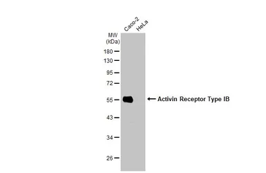 Anti-Activin Receptor Type IB antibody [HL1266] used in Western Blot (WB). GTX636668