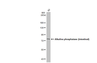 Anti-Alkaline phosphatase (intestinal) antibody [HL1268] used in Western Blot (WB). GTX636670