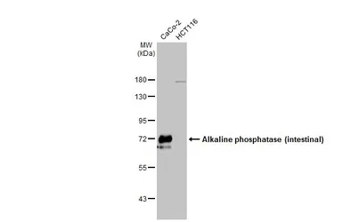 Anti-Alkaline phosphatase (intestinal) antibody [HL1268] used in Western Blot (WB). GTX636670