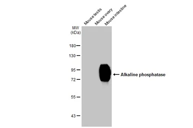Anti-Alkaline phosphatase (intestinal) antibody [HL1268] used in Western Blot (WB). GTX636670