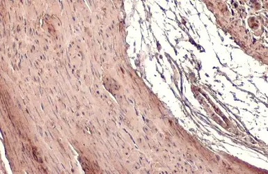 Anti-Transgelin antibody [HL1270] used in IHC (Paraffin sections) (IHC-P). GTX636672