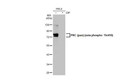 Anti-PKC (pan) (zeta phospho Thr410) antibody [HL1278] used in Western Blot (WB). GTX636680