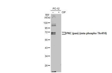 Anti-PKC (pan) (zeta phospho Thr410) antibody [HL1278] used in Western Blot (WB). GTX636680