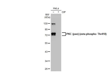 Anti-PKC (pan) (zeta phospho Thr410) antibody [HL1279] used in Western Blot (WB). GTX636681