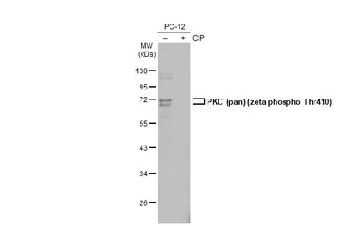 Anti-PKC (pan) (zeta phospho Thr410) antibody [HL1279] used in Western Blot (WB). GTX636681