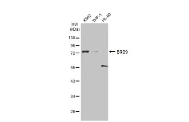 Anti-BRD9 antibody [HL1282] used in Western Blot (WB). GTX636696