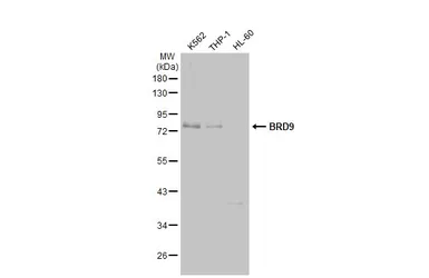 Anti-BRD9 antibody [HL1282] used in Western Blot (WB). GTX636696