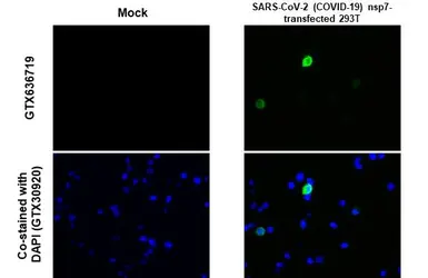 Anti-SARS-CoV-2 (COVID-19) nsp7 antibody [HL1301] used in IHC-P (cell pellet) (IHC-P (cell pellet)). GTX636719