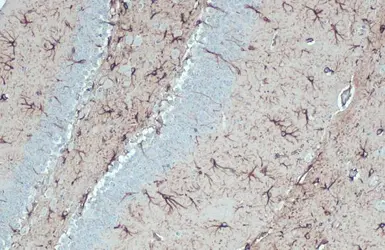 国内外の人気が集結 antibody Anti-GFAP [HL1307] GeneTex | (GTX636725) パック・フェイスマスク