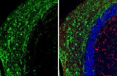 Anti-GFAP antibody [HL1307] used in IHC (Paraffin sections) (IHC-P). GTX636725