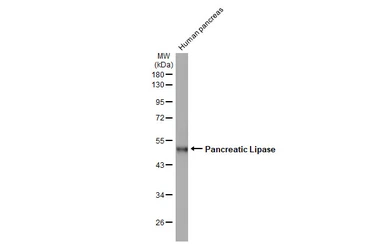 Anti-Pancreatic Lipase antibody [HL1310] used in Western Blot (WB). GTX636728