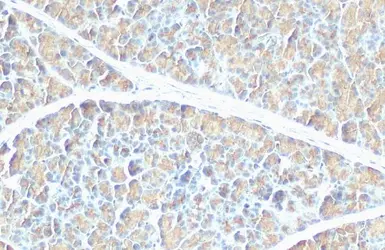 Anti-Pancreatic Lipase antibody [HL1310] used in IHC (Paraffin sections) (IHC-P). GTX636728