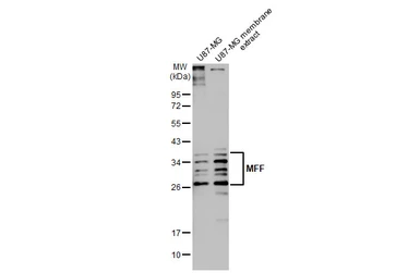 Anti-MFF antibody [HL1313] used in Western Blot (WB). GTX636731