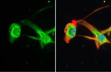Anti-MFF antibody [HL1313] used in Immunocytochemistry/ Immunofluorescence (ICC/IF). GTX636731