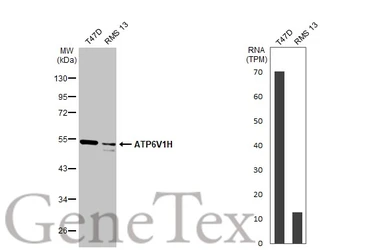 Anti-ATP6V1H antibody [HL1316] used in Western Blot (WB). GTX636734