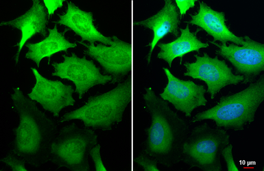 Anti-GSPT1 antibody [HL1346] used in Immunocytochemistry/ Immunofluorescence (ICC/IF). GTX636766