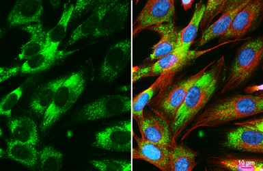 Anti-COL4A1 antibody [HL1351] used in Immunocytochemistry/ Immunofluorescence (ICC/IF). GTX636771