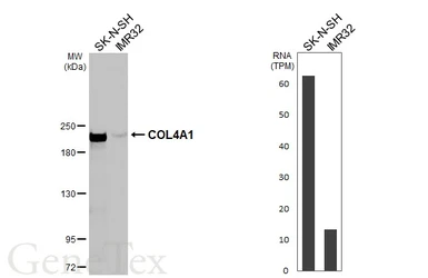Anti-COL4A1 antibody [HL1351] used in Western Blot (WB). GTX636771