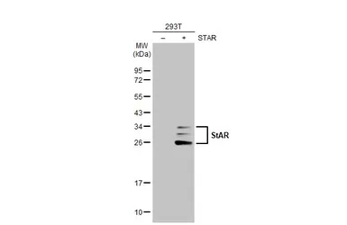 Anti-StAR antibody [HL1360] used in Western Blot (WB). GTX636800