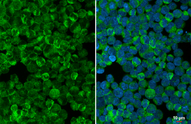 Anti-StAR antibody [HL1360] used in Immunocytochemistry/ Immunofluorescence (ICC/IF). GTX636800