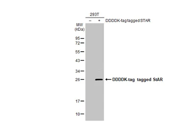 Anti-StAR antibody [HL1362] used in Western Blot (WB). GTX636802