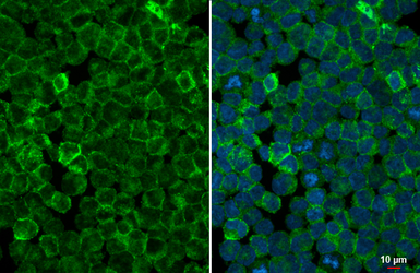 Anti-StAR antibody [HL1362] used in Immunocytochemistry/ Immunofluorescence (ICC/IF). GTX636802