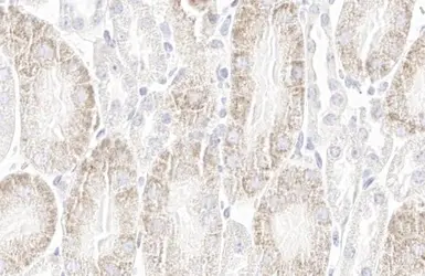 Anti-StAR antibody [HL1362] used in IHC (Paraffin sections) (IHC-P). GTX636802