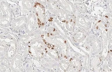 Anti-StAR antibody [HL1362] used in IHC (Paraffin sections) (IHC-P). GTX636802