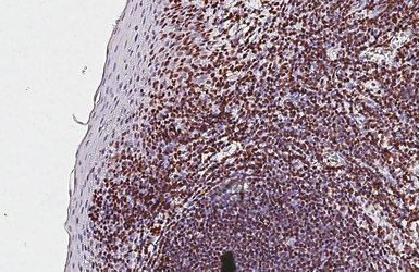 Anti-PARP antibody [HL1365] used in IHC (Paraffin sections) (IHC-P). GTX636805