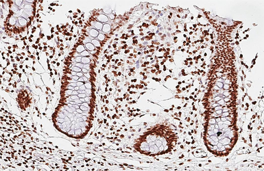 Anti-PARP antibody [HL1365] used in IHC (Paraffin sections) (IHC-P). GTX636805