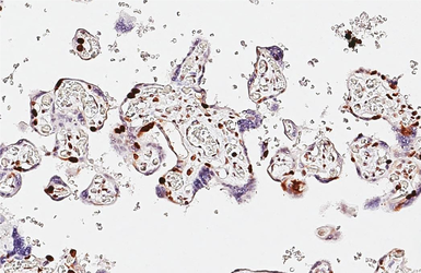 Anti-PARP antibody [HL1365] used in IHC (Paraffin sections) (IHC-P). GTX636805