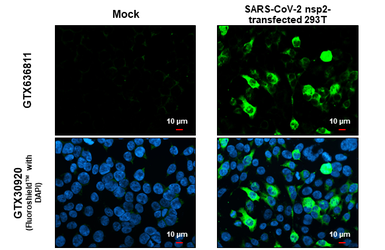 Anti-SARS-CoV-2 (COVID-19) nsp2 antibody [HL1371] used in Immunocytochemistry/ Immunofluorescence (ICC/IF). GTX636811