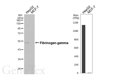 Anti-Fibrinogen gamma antibody [HL1395] used in Western Blot (WB). GTX636835