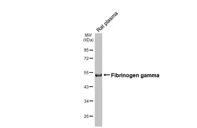 Anti-Fibrinogen gamma antibody [HL1395] used in Western Blot (WB). GTX636835