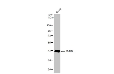Anti-p53R2 antibody [HL1400] used in Western Blot (WB). GTX636840