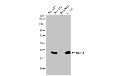 Anti-p53R2 antibody [HL1400] used in Western Blot (WB). GTX636840